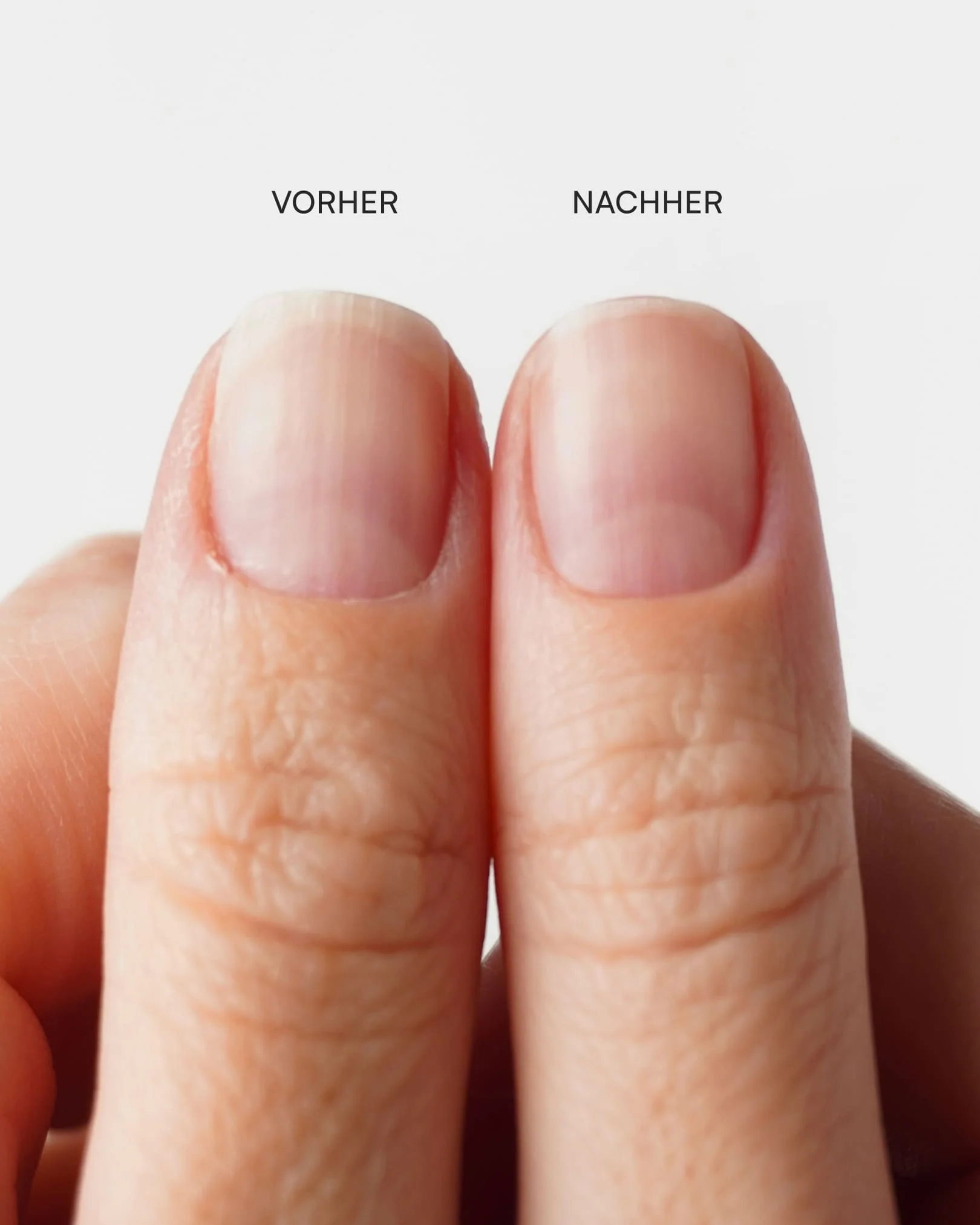 Nagelhautzange - Image 5
